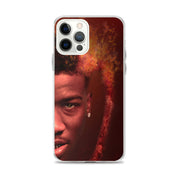 Life Of A Hotboii iPhone Case
